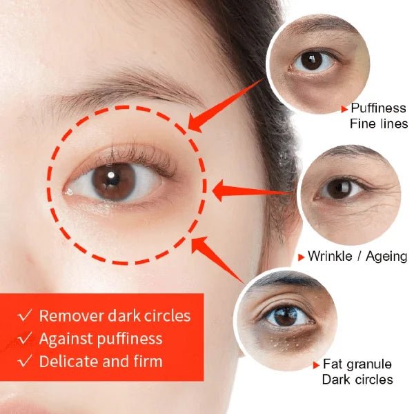🔥Last Day Offer 76%🔥Face Cream,Freckles,Age-spots,Anti-Agening,Treat Melasma,Brighten Skin,(Buy 1 Get 1 Free) *combo*