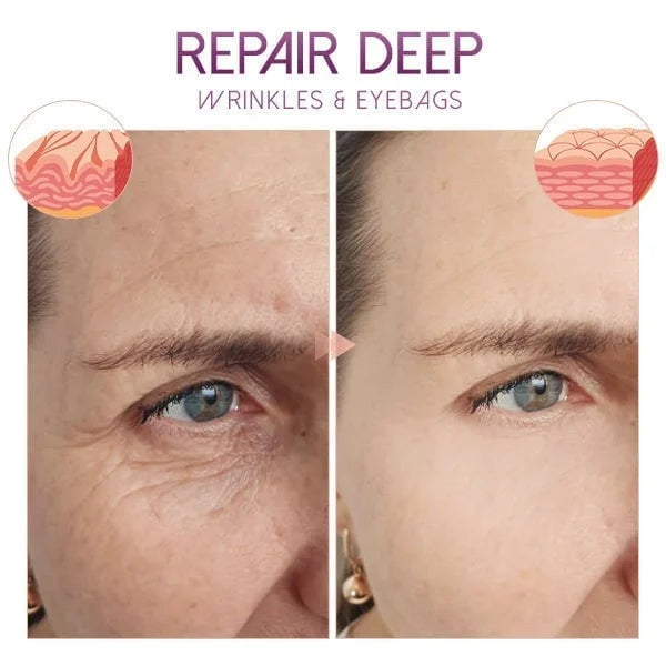 🔥Last Day Offer 76%🔥Face Cream,Freckles,Age-spots,Anti-Agening,Treat Melasma,Brighten Skin,(Buy 1 Get 1 Free) *combo*