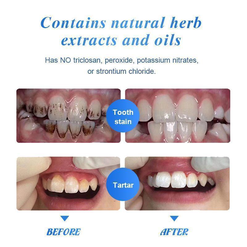 Advanced Stain Removal Toothpaste (Buy 1 Get 2 + Free 2 Special Toothbrush)*Combo*