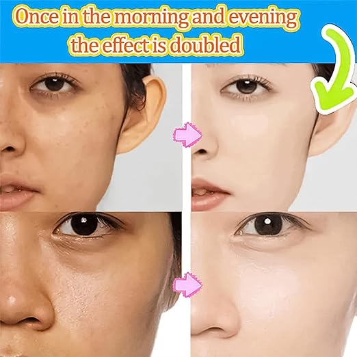 🔥LAST DAY Sale🔥 Korean Skin Whitening Facial Cleanser (BUY 1 GET 1 FREE) (4.9/5 ⭐⭐⭐⭐⭐ 92,024+ BUY)