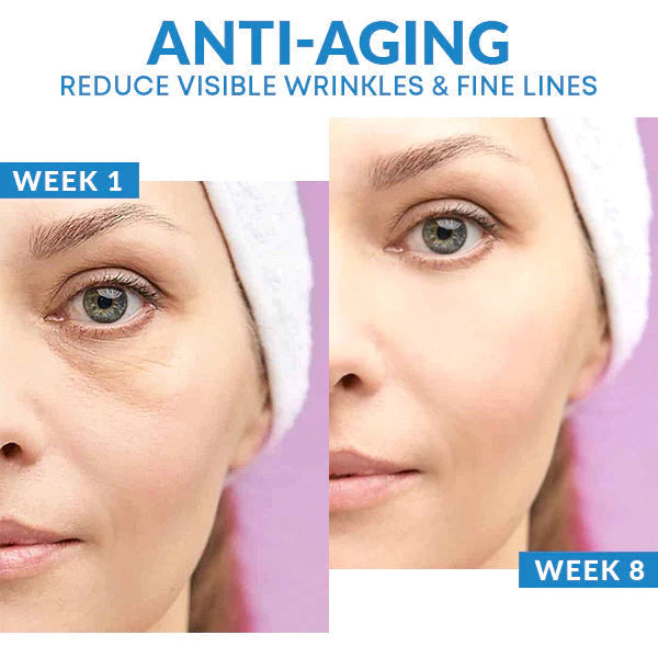 🔥Last Day Offer 76%🔥Face Cream,Freckles,Age-spots,Anti-Agening,Treat Melasma,Brighten Skin,(Buy 1 Get 1 Free) *combo*