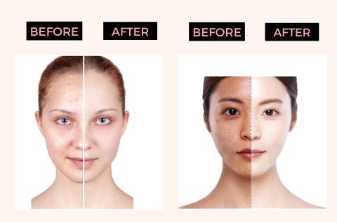 Salicylic ice cream Mask moisturizing (Buy 2 Get 2 Salicylic foaming Face Wash Free)
