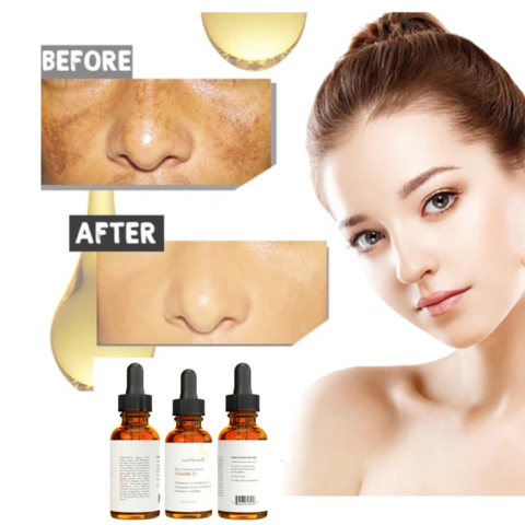 HOT SALE】🔥DARK SPOT New Vitamin C Hyaluronic Acid Serum Moisturizer Facial For Men & Women