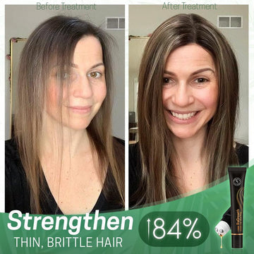 HAIR ORGANIC SERUM ROLLER **Combo**