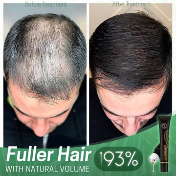 HAIR ORGANIC SERUM ROLLER **Combo**
