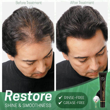 HAIR ORGANIC SERUM ROLLER **Combo**