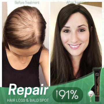 HAIR ORGANIC SERUM ROLLER **Combo**