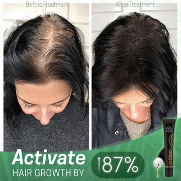 HAIR ORGANIC SERUM ROLLER **Combo**