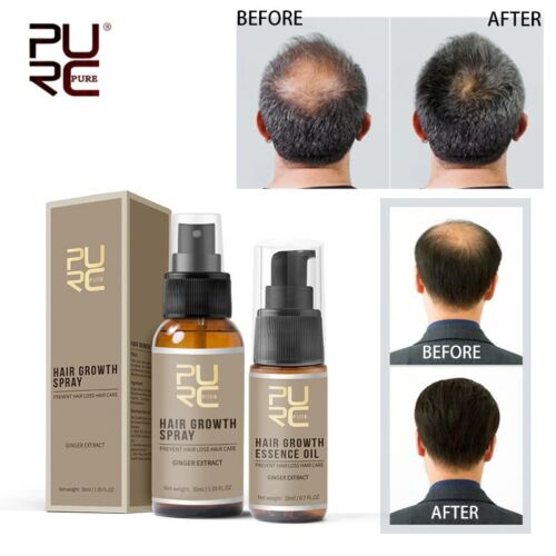 Hair Serum For Hair Growth, Anti - Hairfall, Hair Nourishing Serum For Men & Women(BUY 1 GET 1 FREE) | ⭐⭐⭐⭐⭐